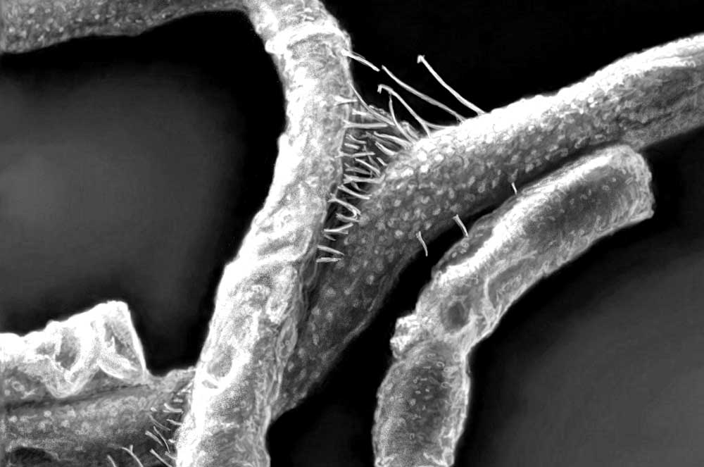 anthrax-bacillus-anthracis - Illustration L’anthrax refait surface en Moselle et décime plusieurs bovins